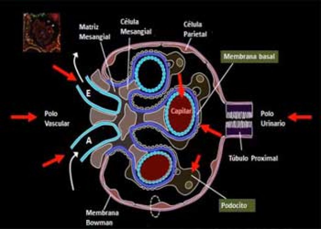 What Causes the Microvascular Complications in Patients with Diabetes Mellitus?