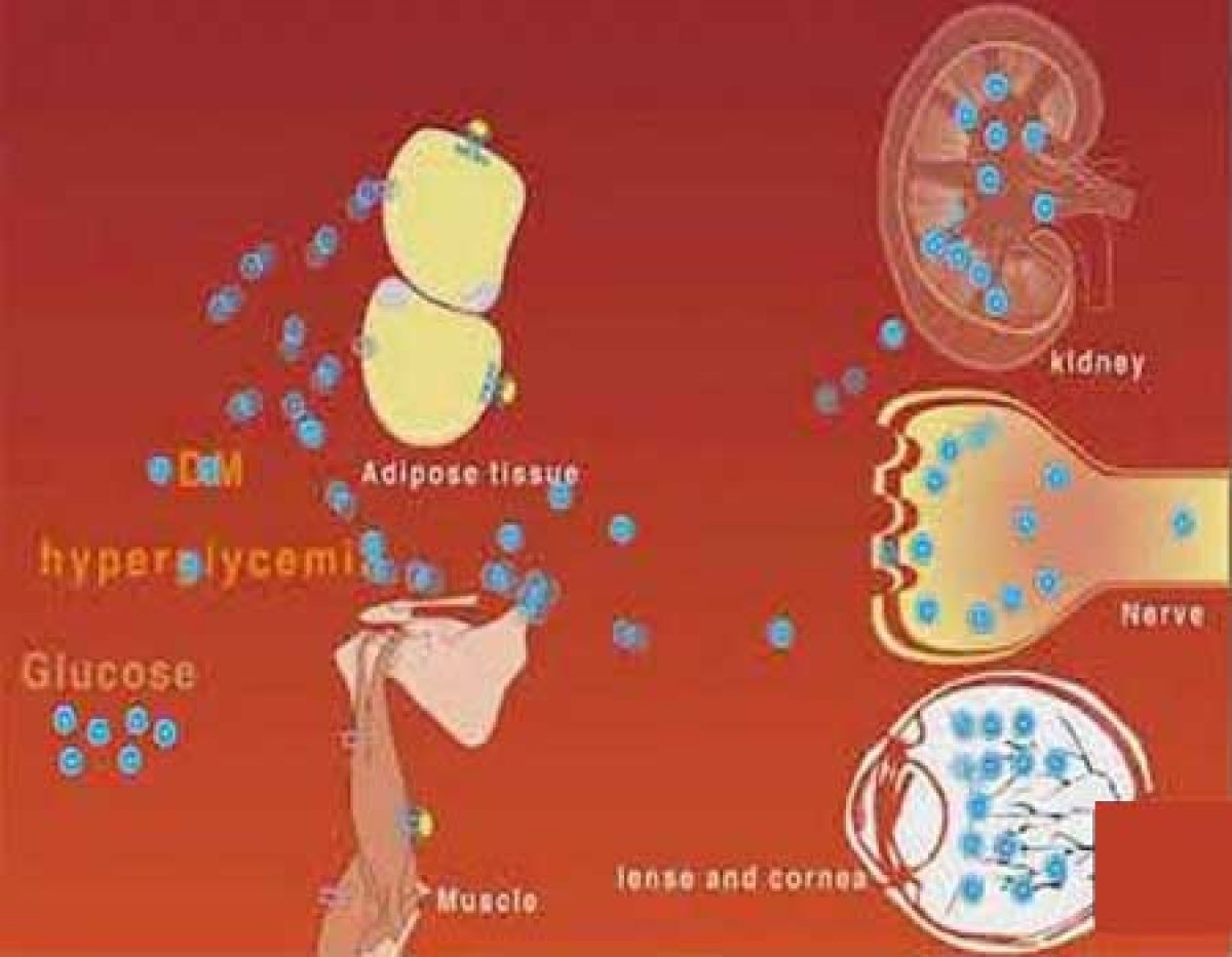 What Causes the Microvascular Complications in Patients with Diabetes Mellitus