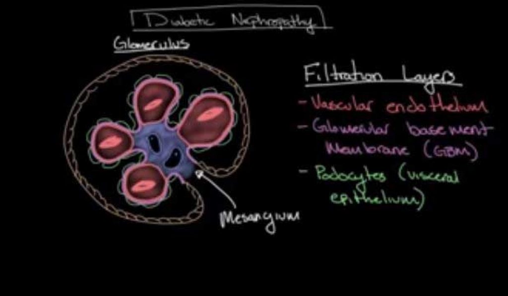 Diabetic nephropathy