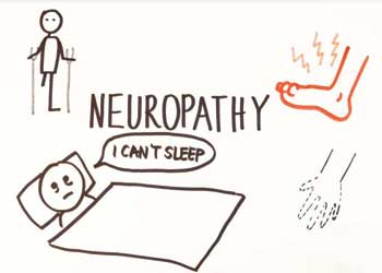 Diabetic Neuropathy Diabetic Neuropathy